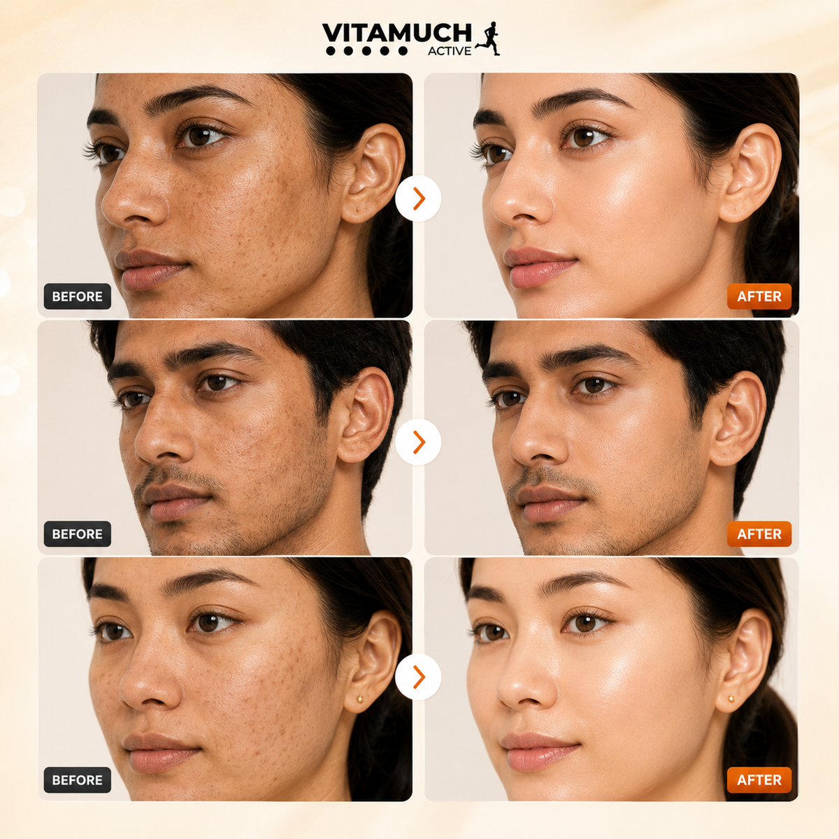 Vitamuch Glutathione Effervescent Tablets for Skin Glow & Brightening | With Vitamin C, Collagen Support & Antioxidants | Active Glow Fizz | 15 Tablets