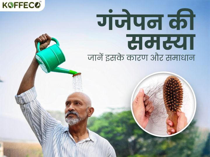 गंजेपन की समस्या: जानें इसके कारण और समाधान